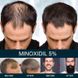 Лосьон-спрей для роста волос Minox 5% (200мл, хватает на 4 месяца)