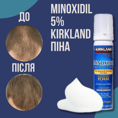 Піна minoxidil 5% KIRKLAND (1 флакон)